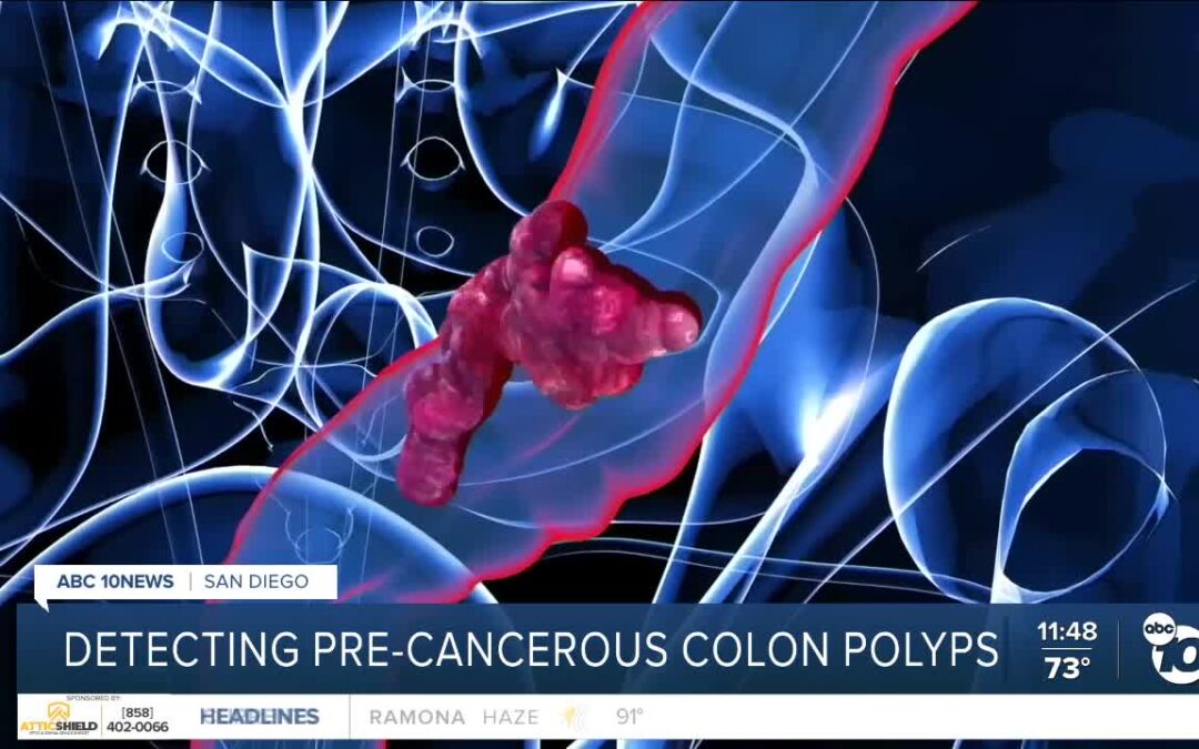 New home-based test from Scripps Research could detect colon cancer earlier, save young adult lives